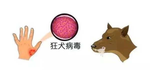 牛管家 预防狂犬病，暴露前免疫也很关键